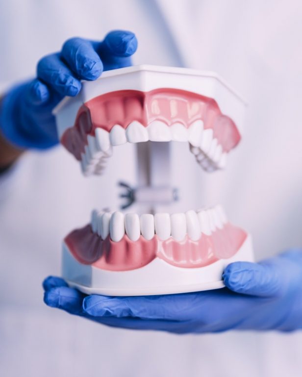 dental-model-of-jaw-.jpg